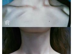 -艾通康缘艾灸.疼痛.睡眠养生馆(凤凰城店)