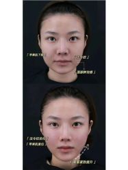 -上海伊莱美医疗美容医院