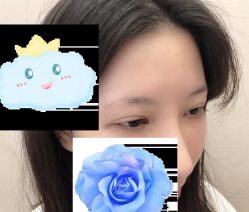 -大麦微针植发丨全国连锁