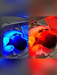 -美肤盾祛痘·问题肌头疗管理中心