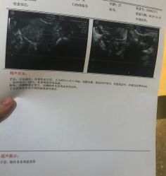 -杭州天目山妇产医院