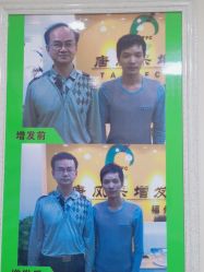 -唐风采假发补发定制