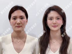-Yestar重庆艺星医疗美容医院