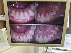 -圣贝口腔(海淀店)