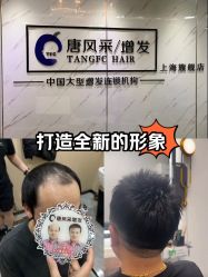 -唐风采假发补发定制