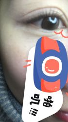 -初樱科技美学问题肌修复中心