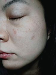 点击看大图 -SKINIST丽铂医疗美容