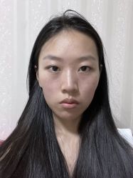 体验前-美莱医学美容医院