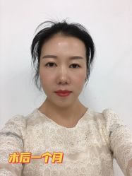 -广州美莱医疗美容医院