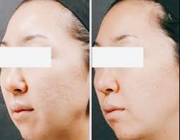 点击看大图 -SKINIST丽铂医疗美容