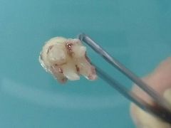 -田锋口腔诊所