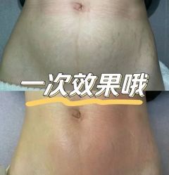 -Lily纤美·科技减脂中心