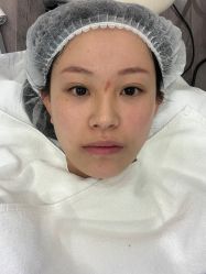 -爱小熊轻医美