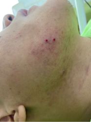 -苗医生草本科技祛痘