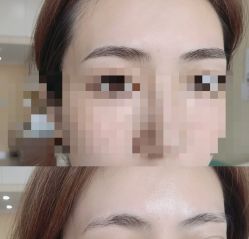 点击看大图 -西施无菌半永久纹绣眉眼影唇轻增发纹发际线
