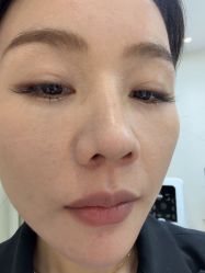 -长沙雅美医疗美容医院