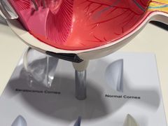 -西安普瑞眼科医院·近视手术·视力防控