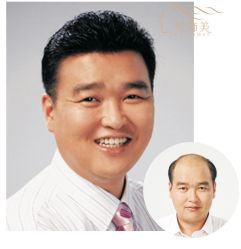 点击看大图 -发饰美男士增发补发假发定制店