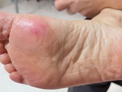 -郑远元专业修脚房(枋湖路店)