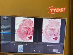 -苑苑vbeauty科技美容SPA