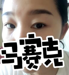 点击看大图 -YooMee优美智能科技美肤机构