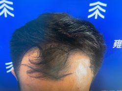 -雍禾植发全国连锁