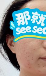 体验后-北京米扬丽格医疗美容·联合丽格鼻整形中心