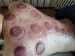 -深蓝盲人推拿·颈肩腰腿疼痛·艾灸调理(清河店)