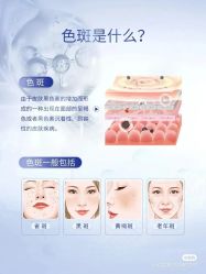 -安吉拉青春化管理中心