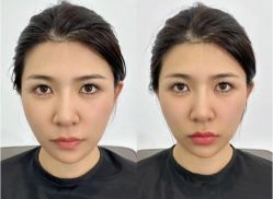 -银川丽都医疗美容医院