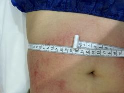 -摩瘦纤体订制减肥