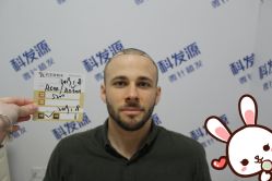 -大麦微针植发丨全国连锁