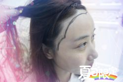 -大麦微针植发全国连锁