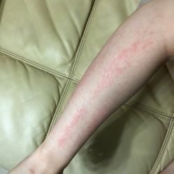 体验后-深圳广和门诊部·整形医疗美容