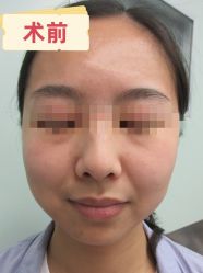 -素美医疗美容·西南眼鼻整形·修复基地