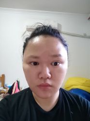 体验后-上海首尔丽格医疗美容医院