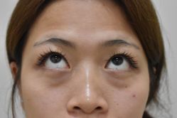 -天津健丽·去眼袋医疗美容机构