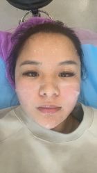 -北京米扬丽格医疗美容·联合丽格鼻整形中心