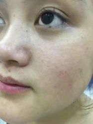 -北京美痣堂古方祛痣斑疣瘊
