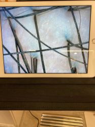 点击看大图 -希梵尔头皮抗衰·科技养发