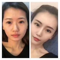 点击看大图 -吉米护肤造型