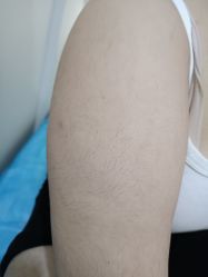 体验前-天津伊美尔医疗整形美容专科医院