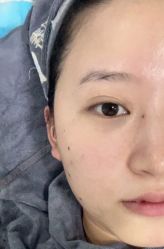 体验后-素妍医疗美容抗衰中心