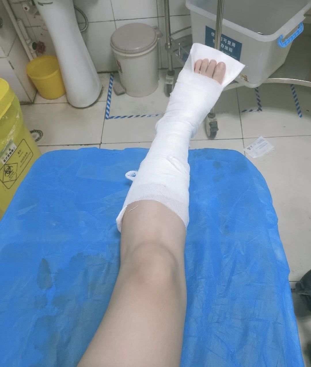 脚步骨折需要躺多久?