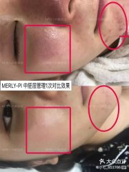 -MLP美丽派·问题肌疗愈中心