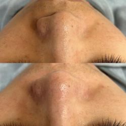 -Cream88颜皮肤管理中心