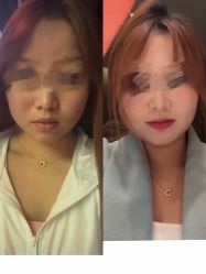 -苏亚医美·高端注射明星整形机构