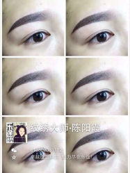 iphone_upload_pic-ILOTTO乐途一站式美学中心