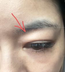 -深圳阳光医疗美容医院·旗舰店