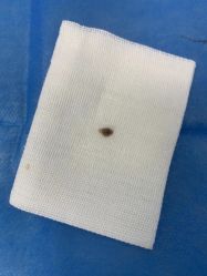 -丽美妍医疗美容·皮秒·立体分层抗衰